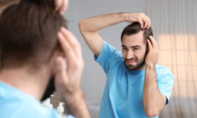 erfelijke vorm van vroegtijdig haarverlies